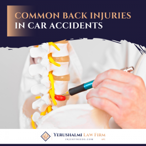 Common Back injuries in car accidents